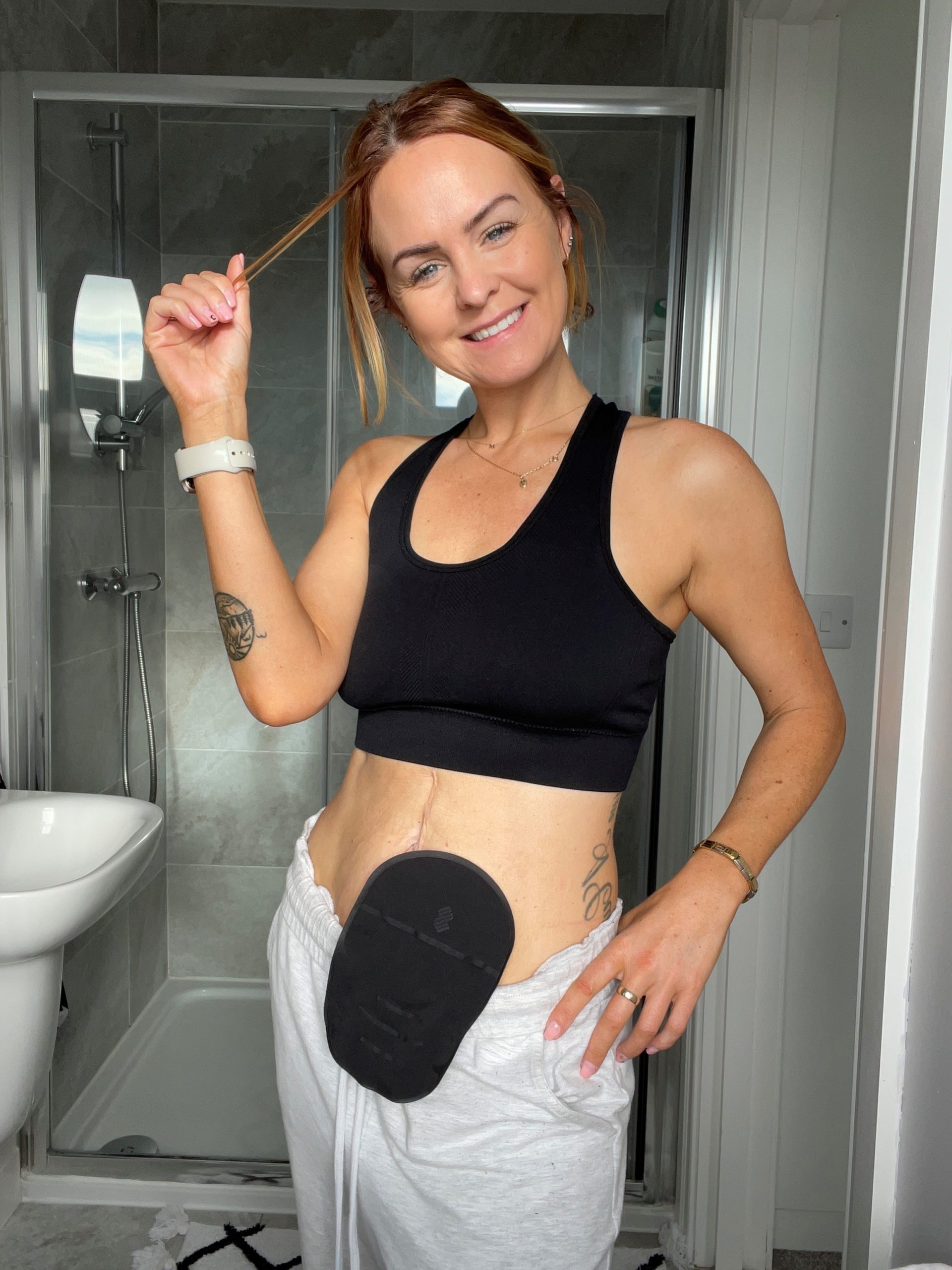 Importance of raising stoma awareness for World Ostomy Day by
