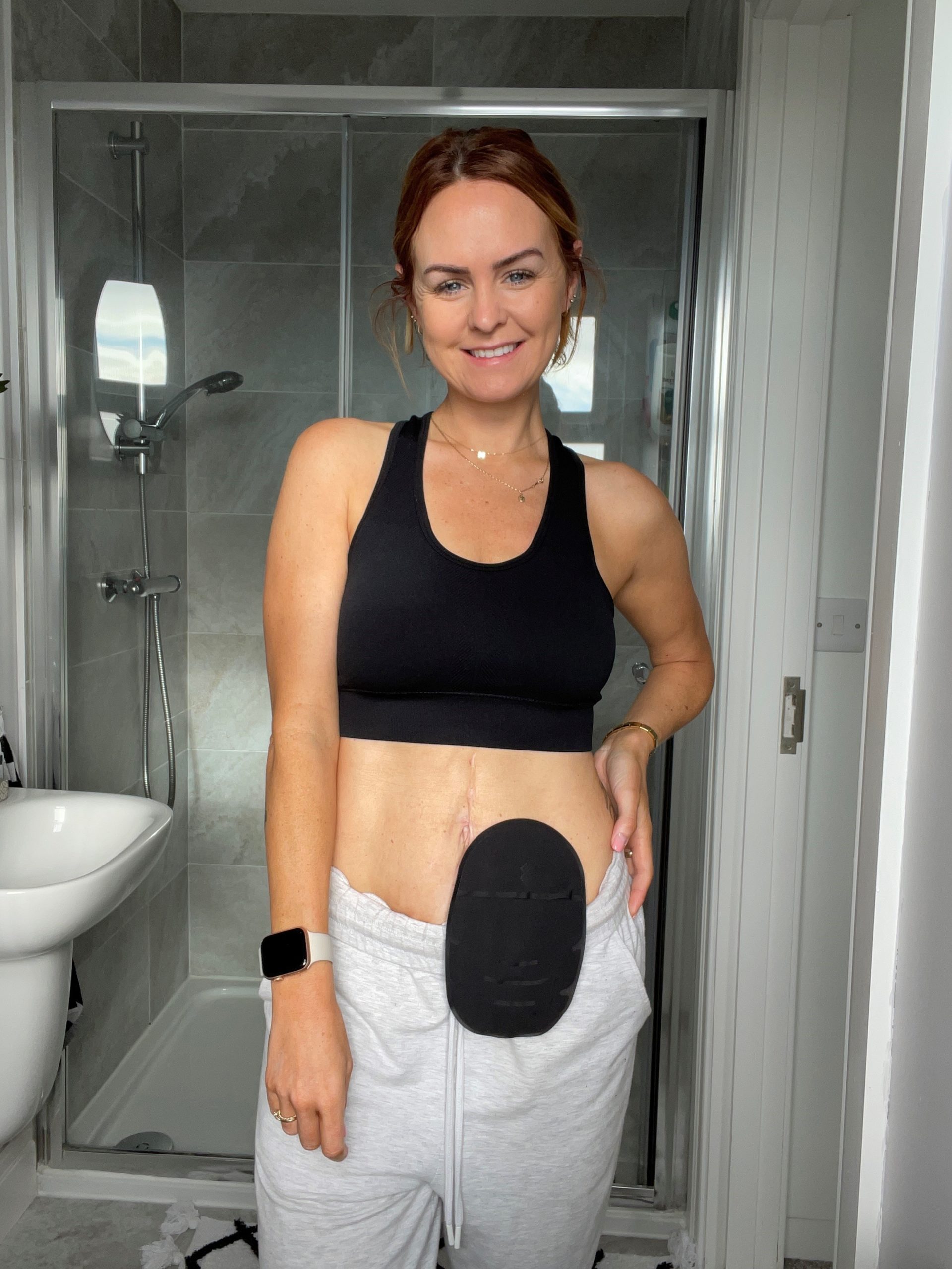 Importance of raising stoma awareness for World Ostomy Day by