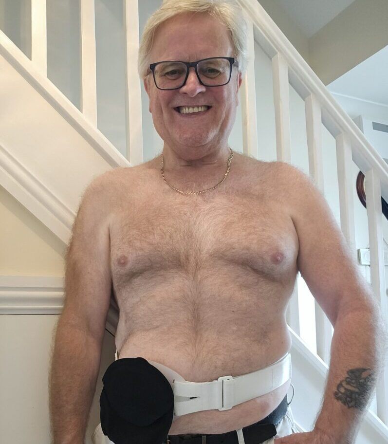 Keith smiles in front of the camera with his stoma bag and stoma belt on.