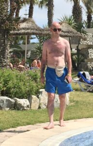 Chris, wearing blue shorts walking next to a pool, soaking up the sun without a shirt on and his stoma bag out!